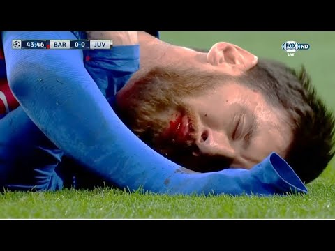 The Day Lionel Messi nearly DIED on the Pitch!